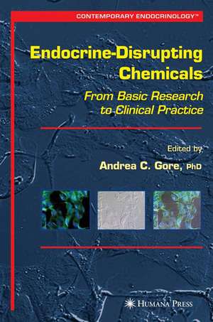 Endocrine-Disrupting Chemicals: From Basic Research to Clinical Practice de Andrea C. Gore