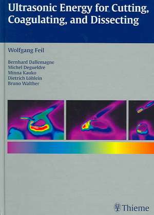 Ultrasonic Energy for Cutting, Coagulating and Dissecting de Wolfgang Feil