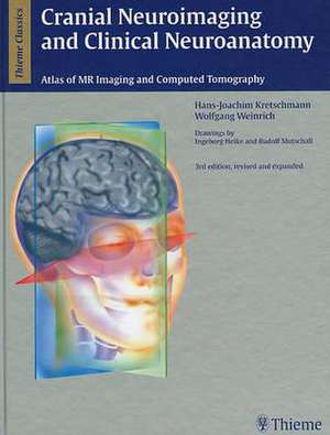 Cranial Neuroimaging and Clinical Neuroanatomy: Magnetic Resonance Imaging andComputed Tomography de Hans-Joachim Kretschmann