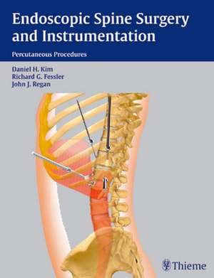 Endoscopic Spine Surgery and Instrumentation de Daniel H. Kim