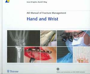 AO Manual of Fracture Management: Hand & Wrist de Jesse Jupiter