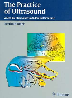 The Practice of Ultrasound: A Step-by-Step Guide to Abdominal Scanning de Berthold Block