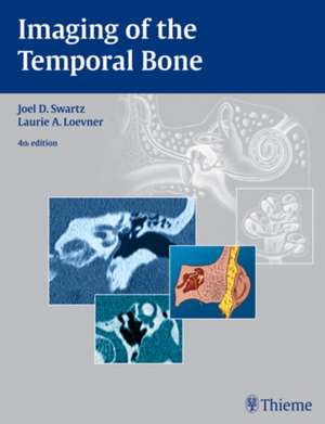 Imaging of the Temporal Bone de Joel D. Swartz