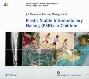 Elastic Stable Intramedullary Nailing (ESIN) in Children de Hans-Georg Dietz