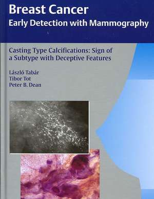 Casting Type Calcifications: Sign of a Subtype with Deceptive Features de Laszlo Tabar