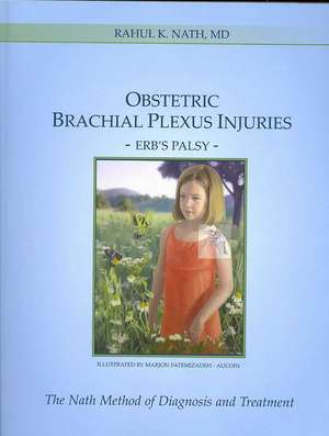 Obstetric Brachial Plexus Injuries de Rahul K. Nath