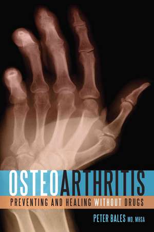 Osteoarthritis: Preventing and Healing Without Drugs de Peter Bales