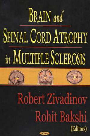 Brain and Spinal Cord Atrophy in Multiple Sclerosis de Robert Zivadinov