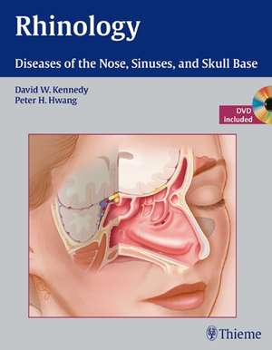 Rhinology – Diseases of the Nose, Sinuses, and Skull Base: incl. DVD de David Kennedy