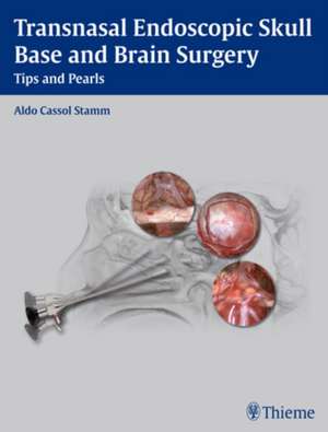 Transnasal Endoscopic Skull Base and Brain Surgery: Tips and Pearls de Aldo C. Stamm