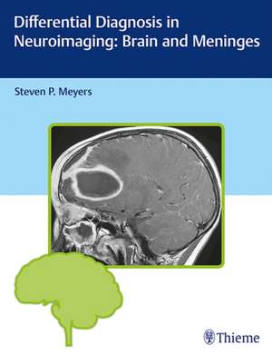 Differential Diagnosis in Neuroimaging: Brain and Meninges de Steven P. Meyers