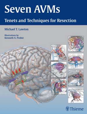 Seven AVMs – Tenets and Techniques for Resection de Michael T. Lawton