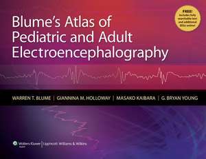 Blume's Atlas of Pediatric and Adult Electroencephalography de Warren T. Blume MD, CM, FRCPC