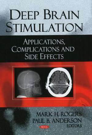 Deep Brain Stimulation de Mark H. Rogers