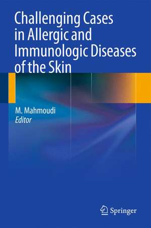 Challenging Cases in Allergic and Immunologic Diseases of the Skin de Massoud Mahmoudi