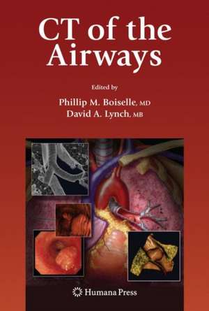 CT of the Airways de Phillip M. Boiselle