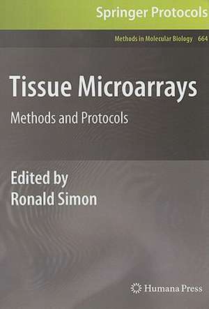 Tissue Microarrays: Methods and Protocols de Ronald Simon