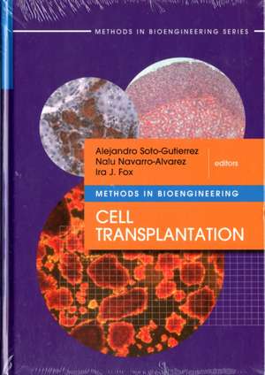 Cell Transplantation de Alejandro Soto-Gutierrez