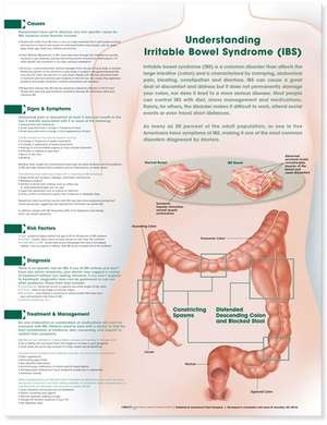 Understanding Irritable Bowel Syndrome Anatomical Chart de Anatomical Chart Company