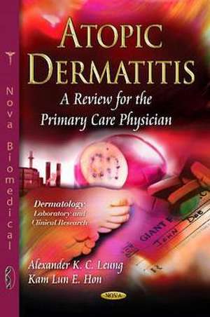 Atopic Dermatitis de Alexander K C Leung