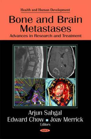 Bone & Brain Metastases de Arjun Sahgal