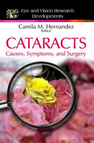 Cataracts de Camila M. Hernandez