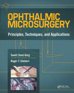 Ophthalmic Microsurgery: Principles, Techniques, and Applications de Sumit Garg