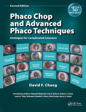 Phaco Chop and Advanced Phaco Techniques: Strategies for Complicated Cataracts de David F. Chang