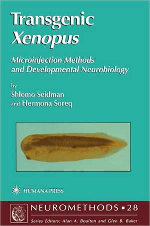 Transgenic Xenopus: Microinjection Methods and Developmental Neurobiology de Shlomo Seidman