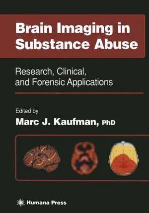 Brain Imaging in Substance Abuse: Research, Clinical, and Forensic Applications de Marc J. Kaufman