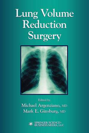 Lung Volume Reduction Surgery de Michael Argenziano