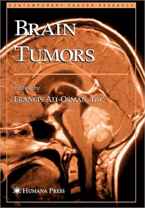 Brain Tumors de Francis Ali-Osman