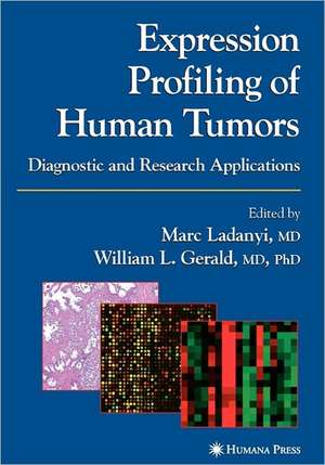 Expression Profiling of Human Tumors: Diagnostic and Research Applications de Marc Ladanyi