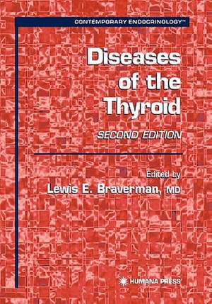 Diseases of the Thyroid de Lewis E. Braverman