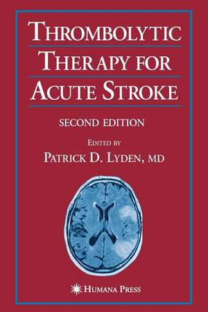 Thrombolytic Therapy for Acute Stroke de Patrick D. Lyden