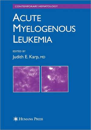 Acute Myelogenous Leukemia de Judith E. Karp