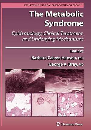 The Metabolic Syndrome:: Epidemiology, Clinical Treatment, and Underlying Mechanisms de Barbara C. Hansen