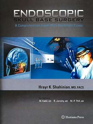 Endoscopic Skull Base Surgery: A Comprehensive Guide with Illustrative Cases de Hrayr K. Shahinian