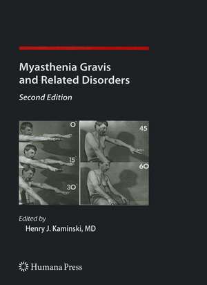 Myasthenia Gravis and Related Disorders de Henry J. Kaminski