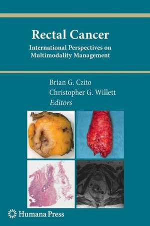 Rectal Cancer: International Perspectives on Multimodality Management de Brian G. Czito