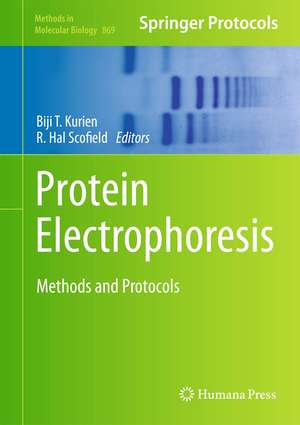 Protein Electrophoresis: Methods and Protocols de Biji T. Kurien