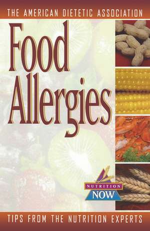 Food Allergies: The Nutrition Now Series de The American Dietetic Association