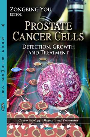 Prostate Cancer Cells de Zongbing You