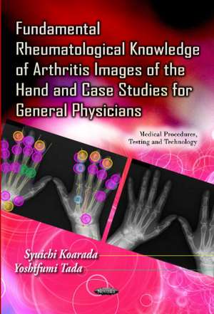 Fundamental Rheumatological Knowledge of Arthritis Images of the Hand & Case Studies for General Physicians de Syuichi Koarada