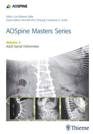 AOSpine Master Series, Vol. 4: Adult Spinal Deform ities de L Lenke