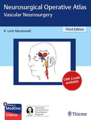 Neurosurgical Operative Atlas Spine And Peripheral Ponto