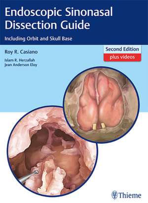 Endoscopic Sinonasal Dissection Guide de Roy R Casiano