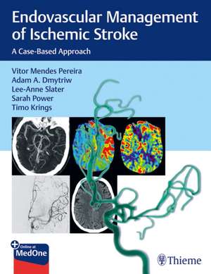 Endovascular Management of Ischemic Stroke de V Pereira