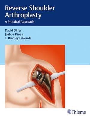 Reverse Shoulder Arthroplasty – A Practical Approach de David M. Dines