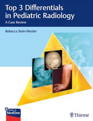 Top 3 Differentials in Pediatric Radiology – A Case Review de Rebecca Stein–wexler